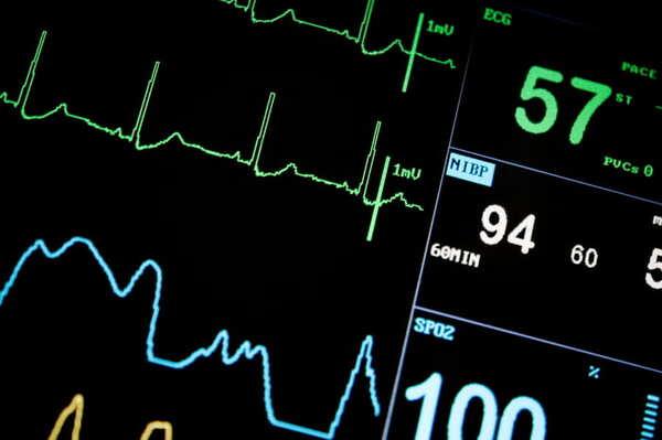 Monitoraggio emodinamico intensivo