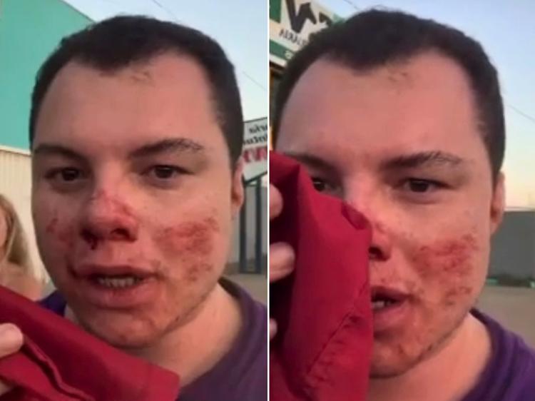 Influenciador agredido por estudantes em festa universitária deixa UTI no interior de SP