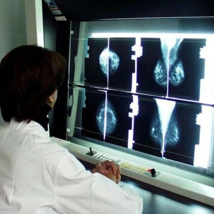 Una donna in Usa è in remissione dal tumore senza alcuna cura