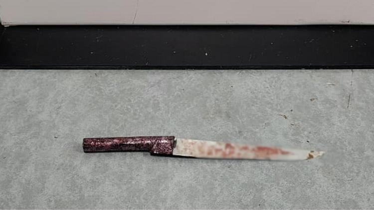 Mulher sobrevive após ser esfaqueada quatro vezes pelo companheiro no RS; polícia investiga tentativa de feminicídio