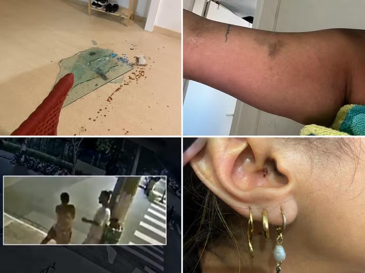 Orelha queimada, casa quebrada, hematomas e testemunhas: entenda denúncia contra Cartolouco por agressão