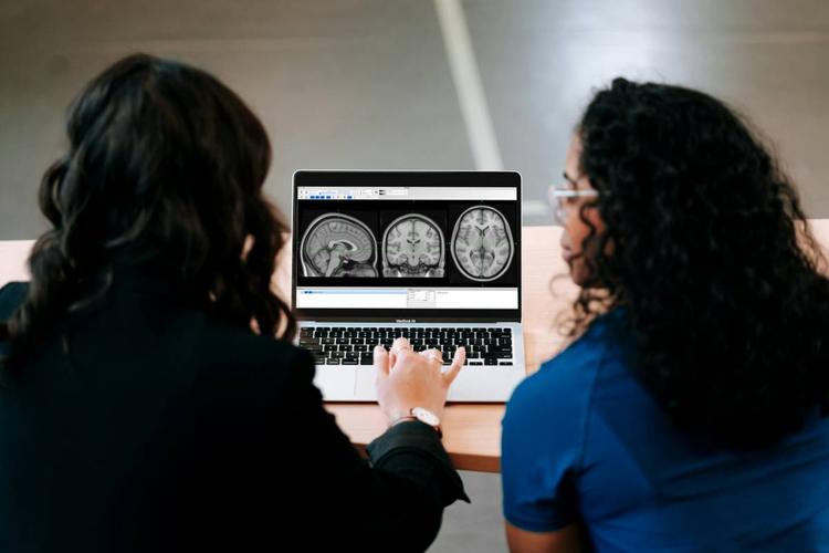 Alzheimer, potenziare una proteina (Sox9) aiuta il cervello a combattere la malattia