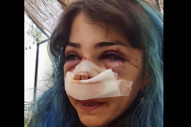 Bari, Giuditta D’Elia nuovamente aggredita al parco Rossani: il suo racconto