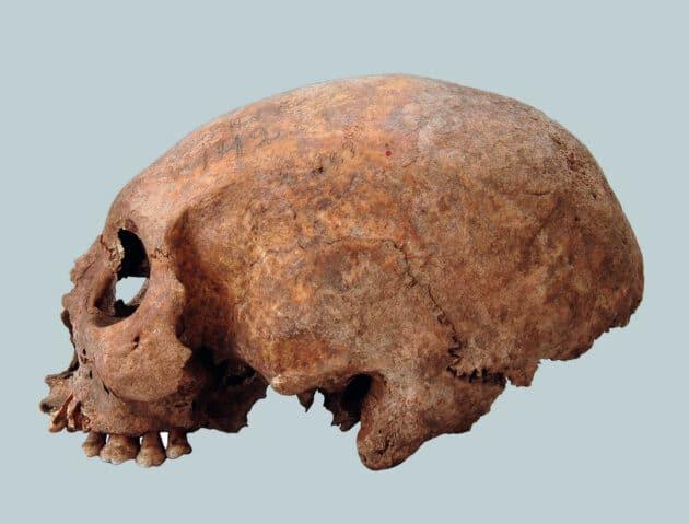 Eine von drei künstlich zu einem Langschädel deformierten Wikinger-Schädel aus dem 11. Jahrhundert auf Gotland.Quelle/Copyright: SHM/Johnny Karlson 2008-11-05 / CC BY 2.5 SE