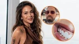 Odontólogo alerta sobre dientes de Greeicy: “Tiene infección”