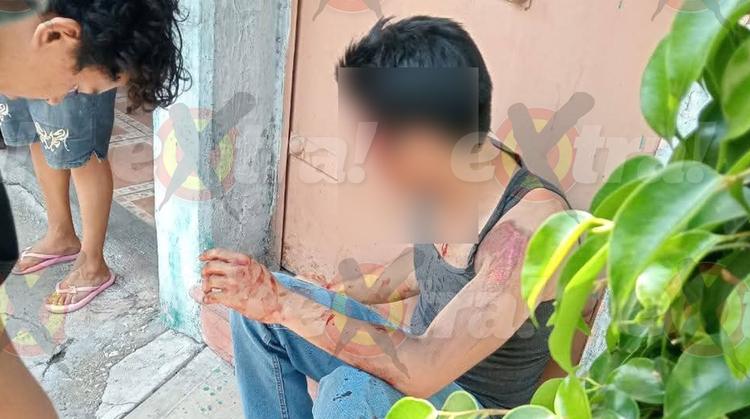 ¡No traía casco! Joven derrapa en Cuautla y pierde la memoria tras brutal golpe