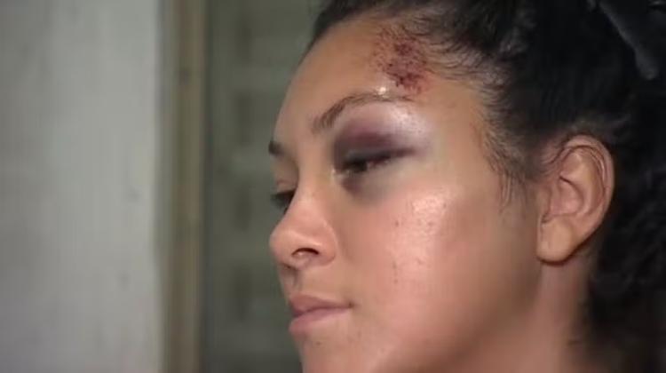 Jovem relata momentos de tensão ao ser arrastada por carro de aplicativo no interior de SP