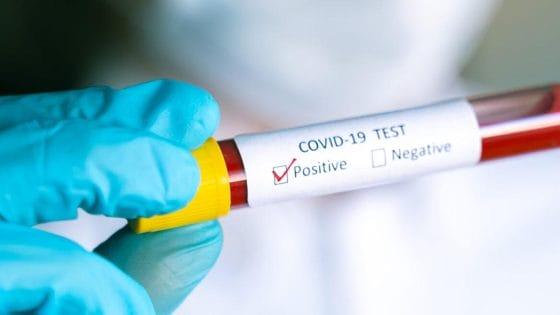 Coronavirus in Toscana, 87 nuovi casi. Un decesso