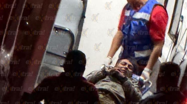 ¡Brutal impacto! Conductor veloz manda al hospital a joven motociclista en Yautepec