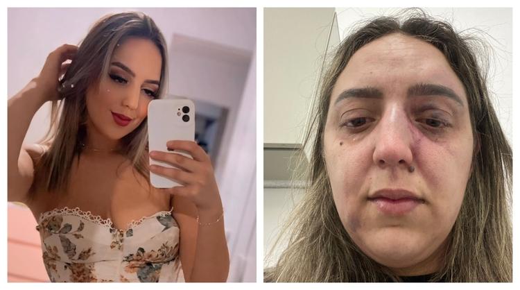 Ex espanca mulher com socos, chutes e pedaço de madeira em posto de gasolina em SP; 'importante é que sobrevivi', diz vítima